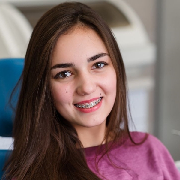 How Long Do You Have To Wear Braces Read This First